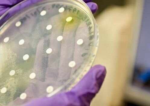 bakterikultuur prostatiidi diagnoosimiseks